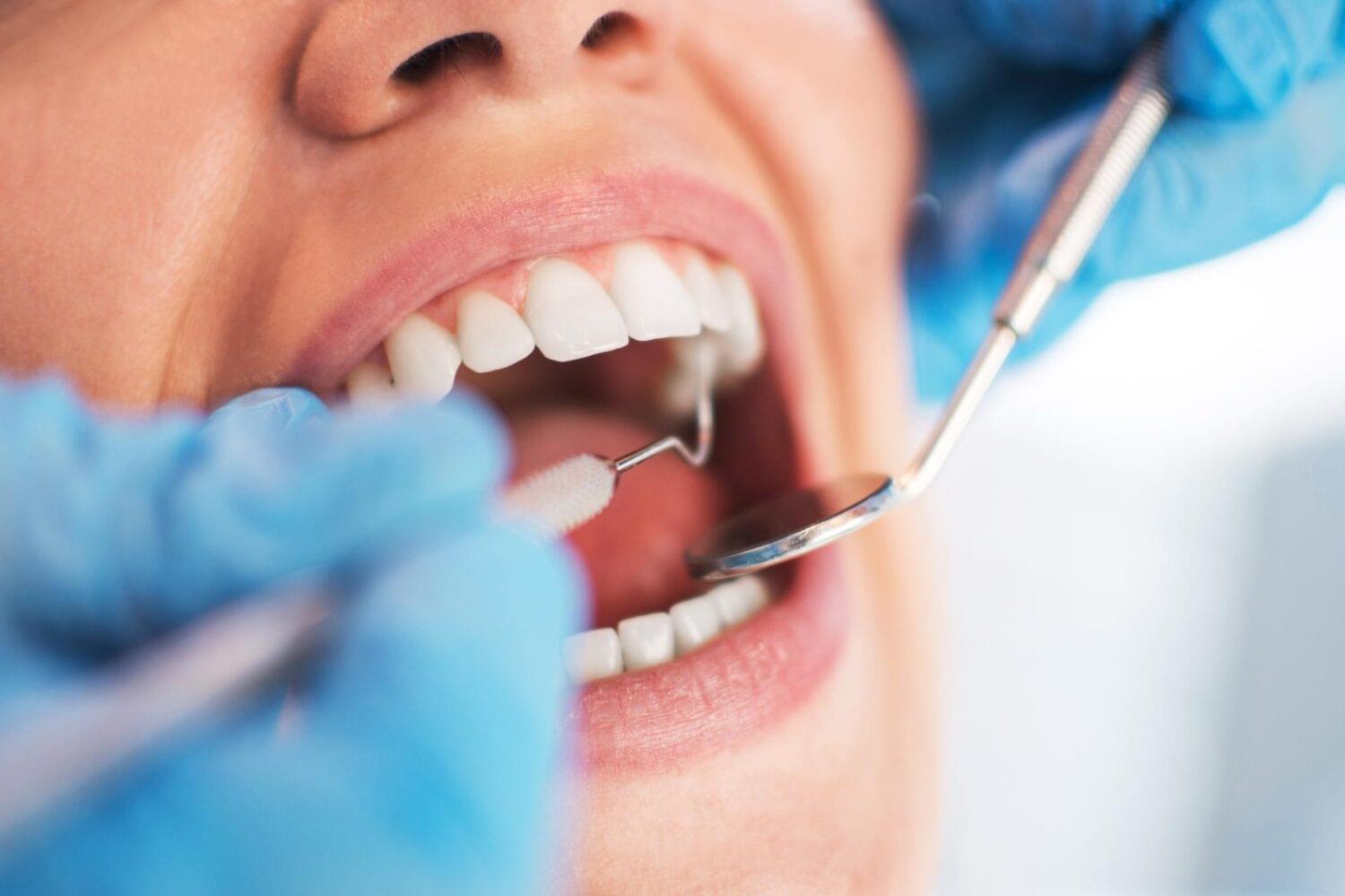 Soins dentaires courants : tout ce que vous devez savoir 17